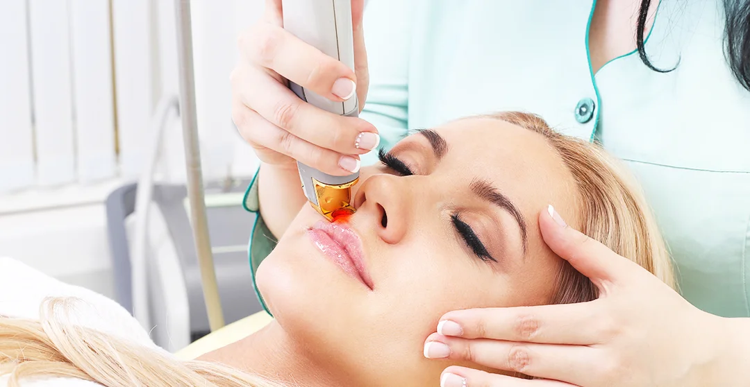 fotoringiovanimento laser Cutera fotoringiovanimento laser Cutera