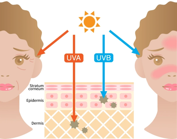 l'effetto dei raggi UVA e UVB sulla pelle