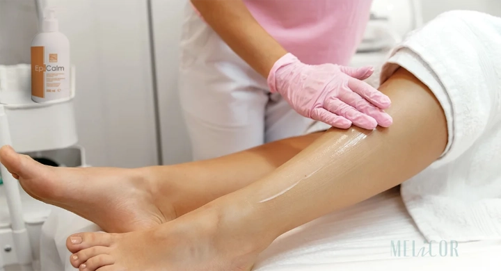 Epicalm crema lenitiva applicata su pelle arrossata dopo epilazione laser Epicalm crema lenitiva applicata su pelle arrossata dopo epilazione laser