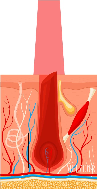 Conversion of laser energy into heat